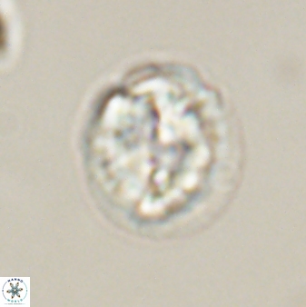 Asinithistimorfi aubryae 57696