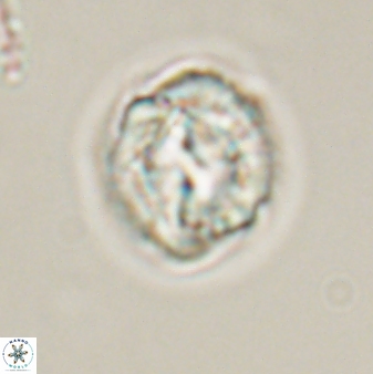 Asinithistimorfi aubryae 57698