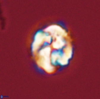 Asinithistimorfi aubryae 57699