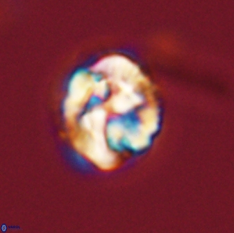 Asinithistimorfi aubryae 57715