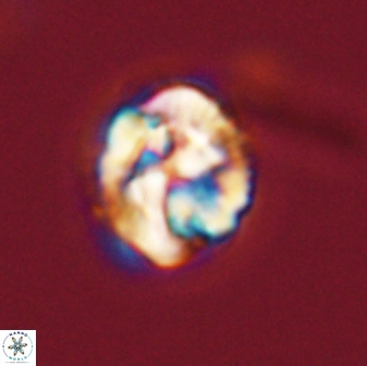 Asinithistimorfi aubryae 57715