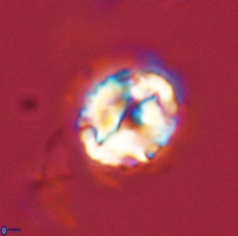 Asinithistimorfi aubryae 58585