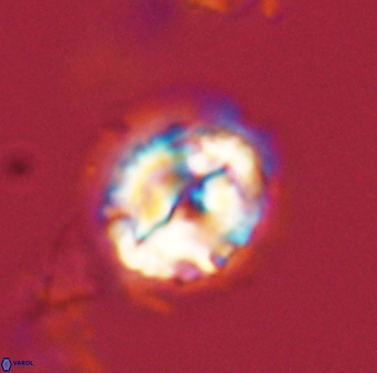 Asinithistimorfi aubryae 58586