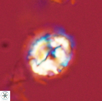 Asinithistimorfi aubryae 58586