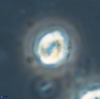 Asinithistimorfi aubryae 64200