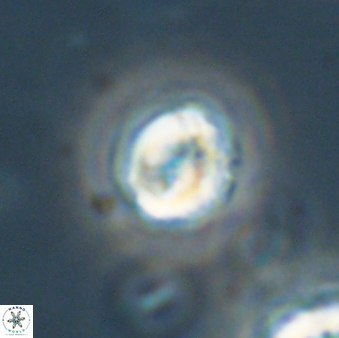 Asinithistimorfi aubryae 64200