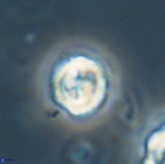 Asinithistimorfi aubryae 64203