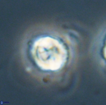 Asinithistimorfi aubryae 64206