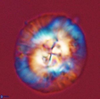 Asperolithus apomnemoneumus 56435