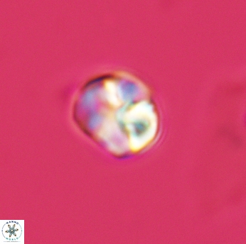 Assipetra infracretacea 3515