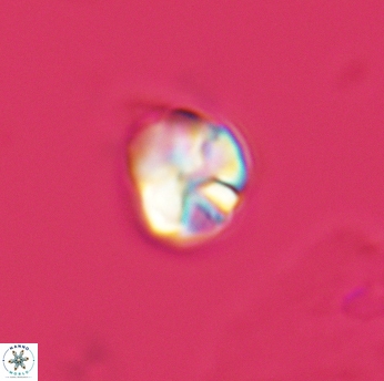 Assipetra infracretacea 3518