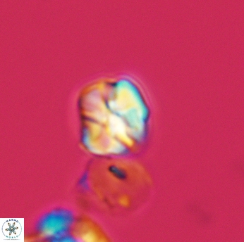 Assipetra infracretacea 3520