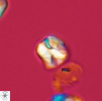 Assipetra infracretacea 3521