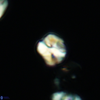 Assipetra infracretacea 3522