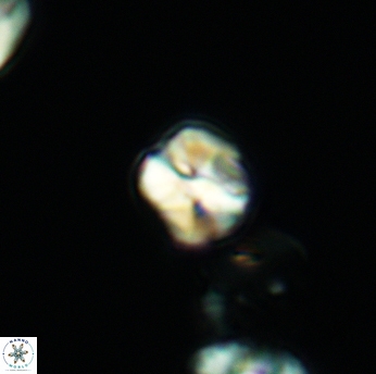 Assipetra infracretacea 3522