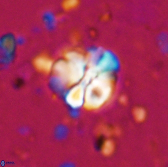 Assipetra terebrodentarius 7178