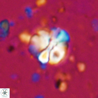Assipetra terebrodentarius 7178