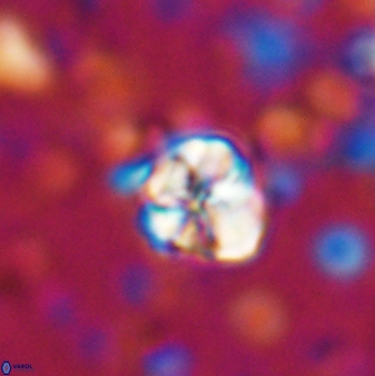 Assipetra terebrodentarius 7198