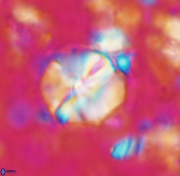 Assipetra terebrodentarius 1239