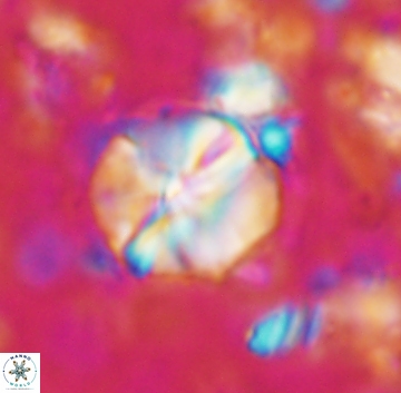 Assipetra terebrodentarius 1239