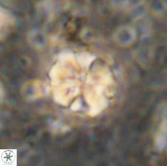 Assipetra terebrodentarius terebrodentarius 7116