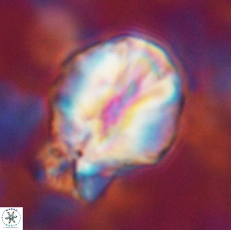 Assipetra terebrodentarius novus 14087