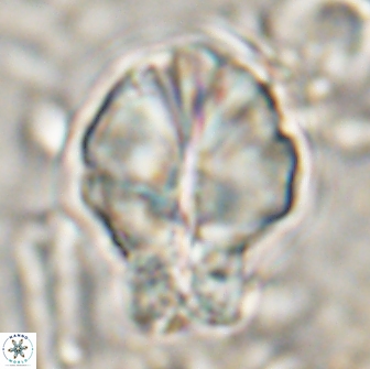 Assipetra terebrodentarius novus 14088