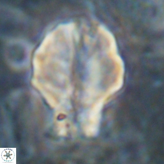 Assipetra terebrodentarius novus 14089