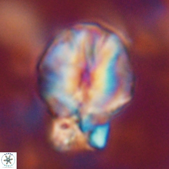 Assipetra terebrodentarius novus 14099