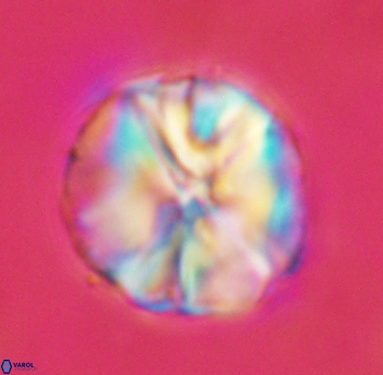 Assipetra youngii 4654