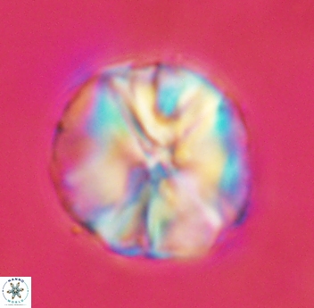 Assipetra youngii 4654