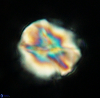 Assipetra youngii 4651