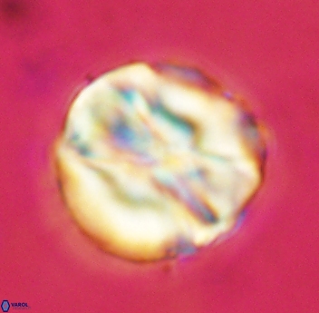 Assipetra youngii 4652