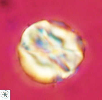 Assipetra youngii 4652