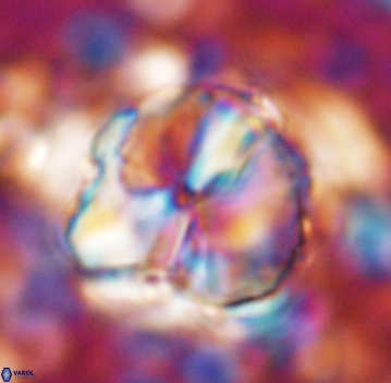 Assipetra youngii 7057