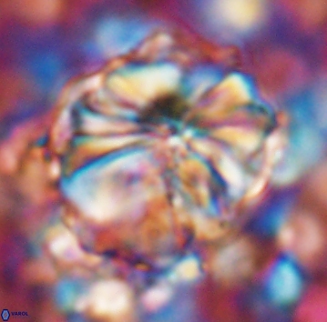 Assipetra youngii 7064