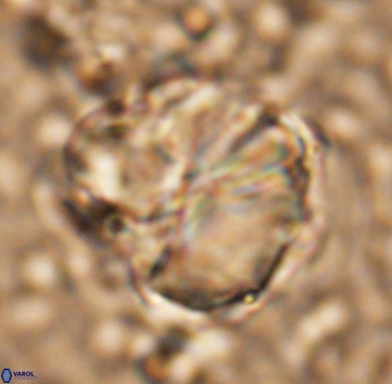 Assipetra youngii 7061