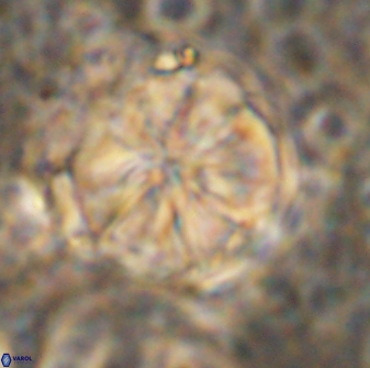 Assipetra youngii 7086