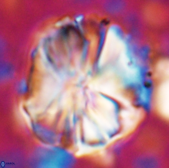 Assipetra youngii 7135