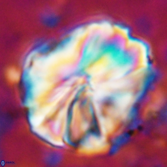 Assipetra youngii 7138