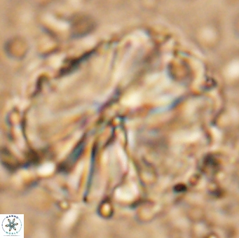 Assipetra youngii 7139