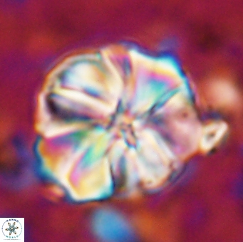 Assipetra youngii 7146