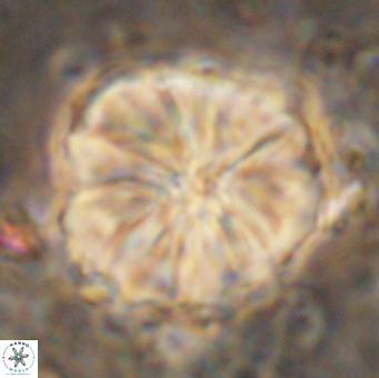 Assipetra youngii 7148