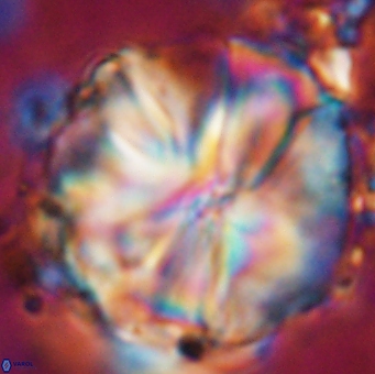 Assipetra youngii 7154