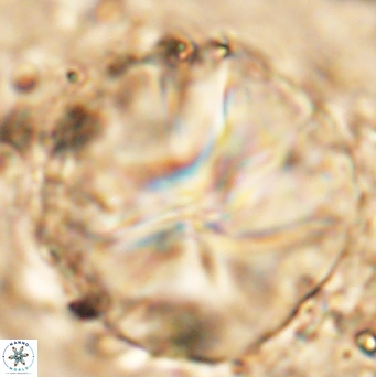 Assipetra youngii 7160