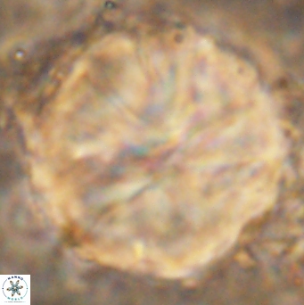 Assipetra youngii 7161