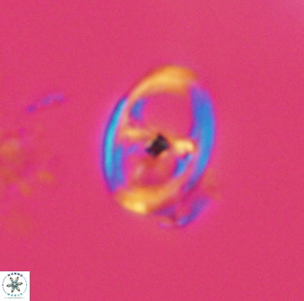 Asynithistostoichos coxalliae 40174