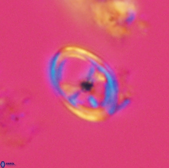 Asynithistostoichos coxalliae 40178