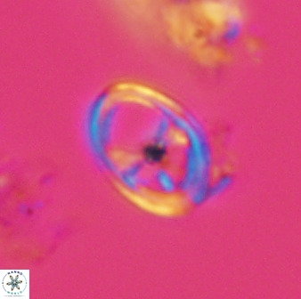 Asynithistostoichos coxalliae 40178