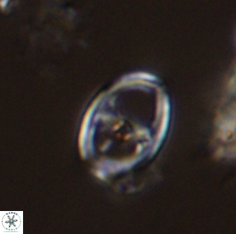 Asynithistostoichos coxalliae 40179